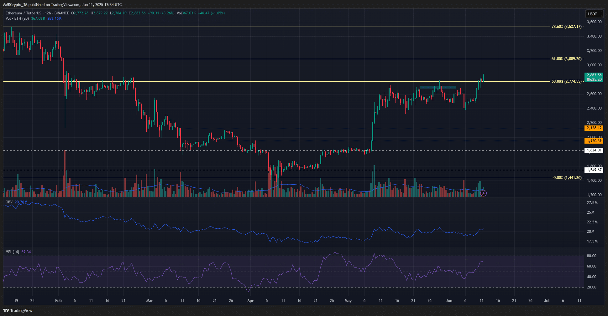 Đà tăng giá Ethereum chững lại tại vùng kháng cự nguồn cung? - Tin Tức Bitcoin - Cập Nhật Tin Tức Coin Mới Nhất 24/7 2025 Ethereum 1-day Chart